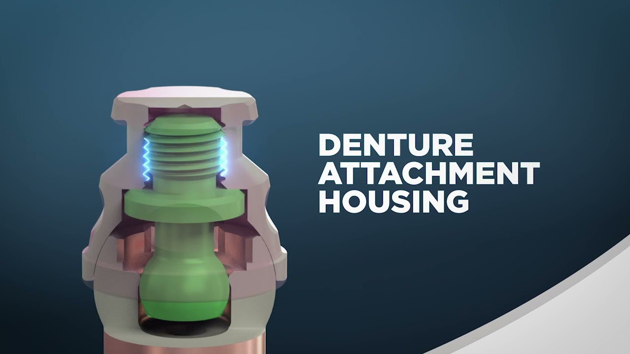 Introducing ZEST LOCATOR F TX Fixed Attachment System   Animation