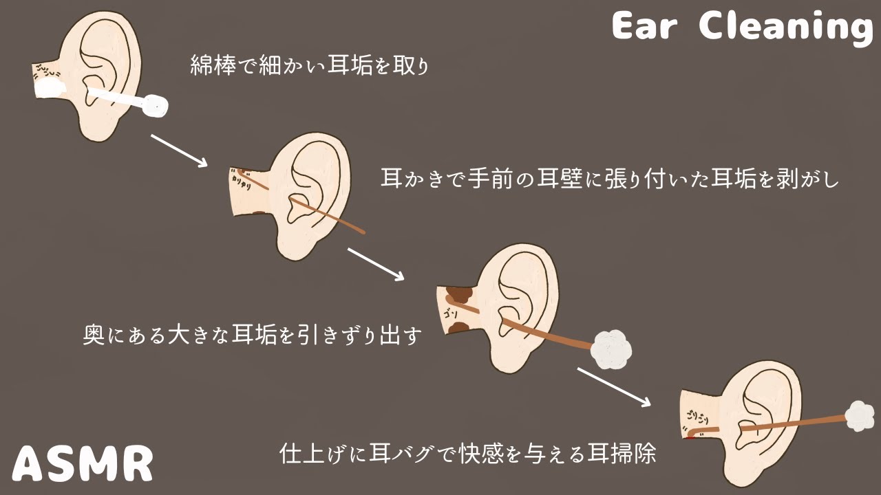 【ASMR】綿棒で細かい耳垢を取り 耳かきで手前の耳壁に張り付いた耳垢を剥がし 奥にある大きな耳垢を引きずり出す 仕上げに耳バグで快感を与える耳掃除 Ear Cleaning