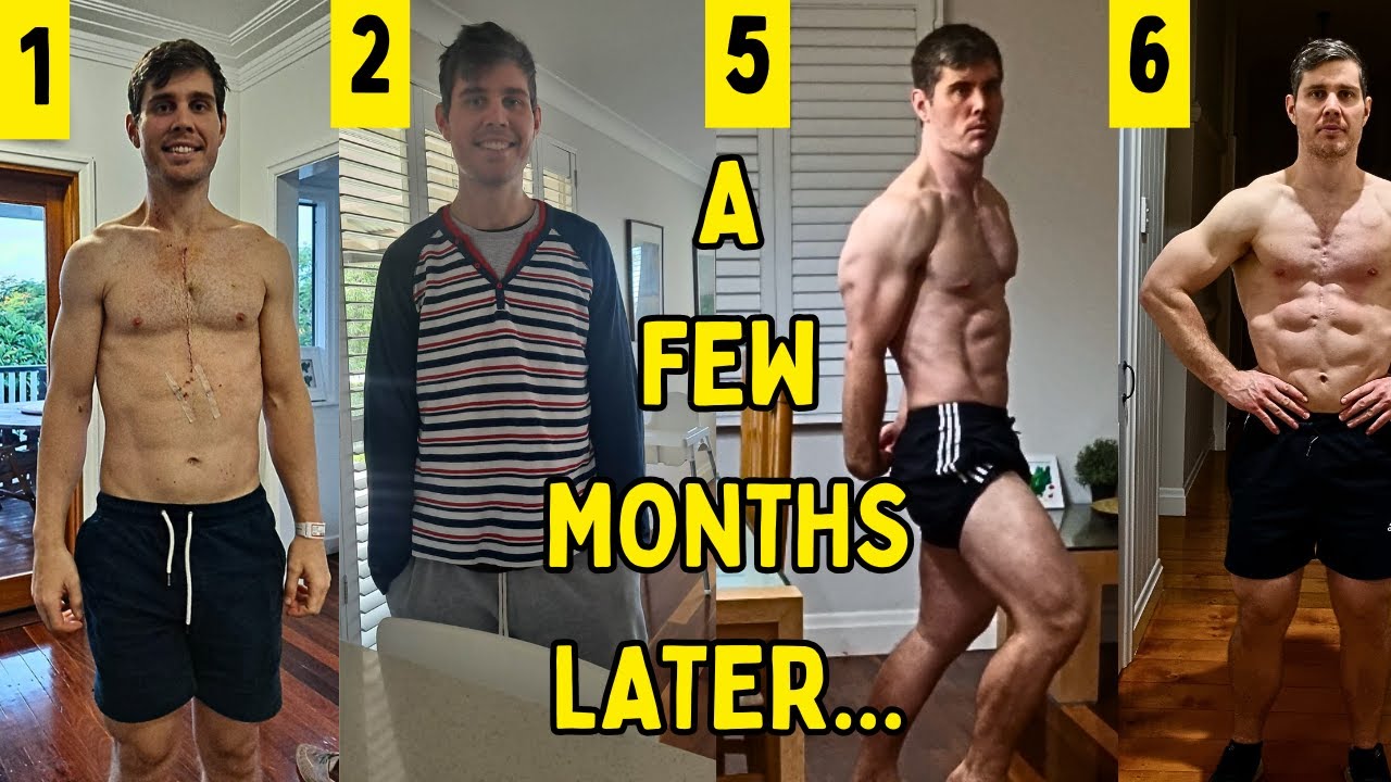 Muscle Memory - Fast Transformation after Heart Surgery - Natural