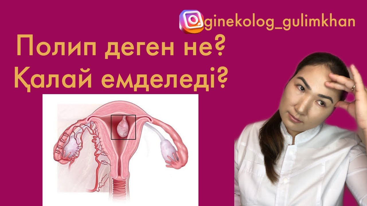 Полип неге пайда болады? Қалай емделеді?