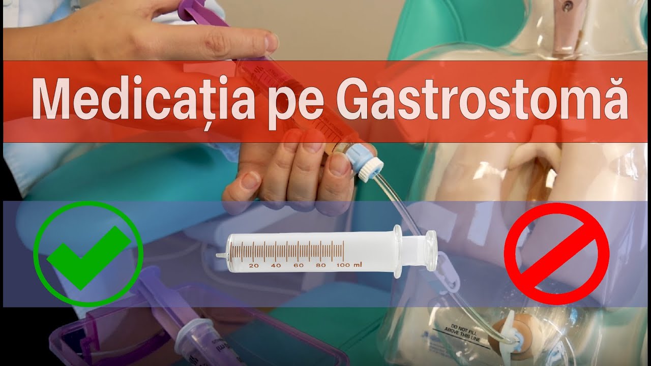 Cum administrez medicația pe Gastrostomă?