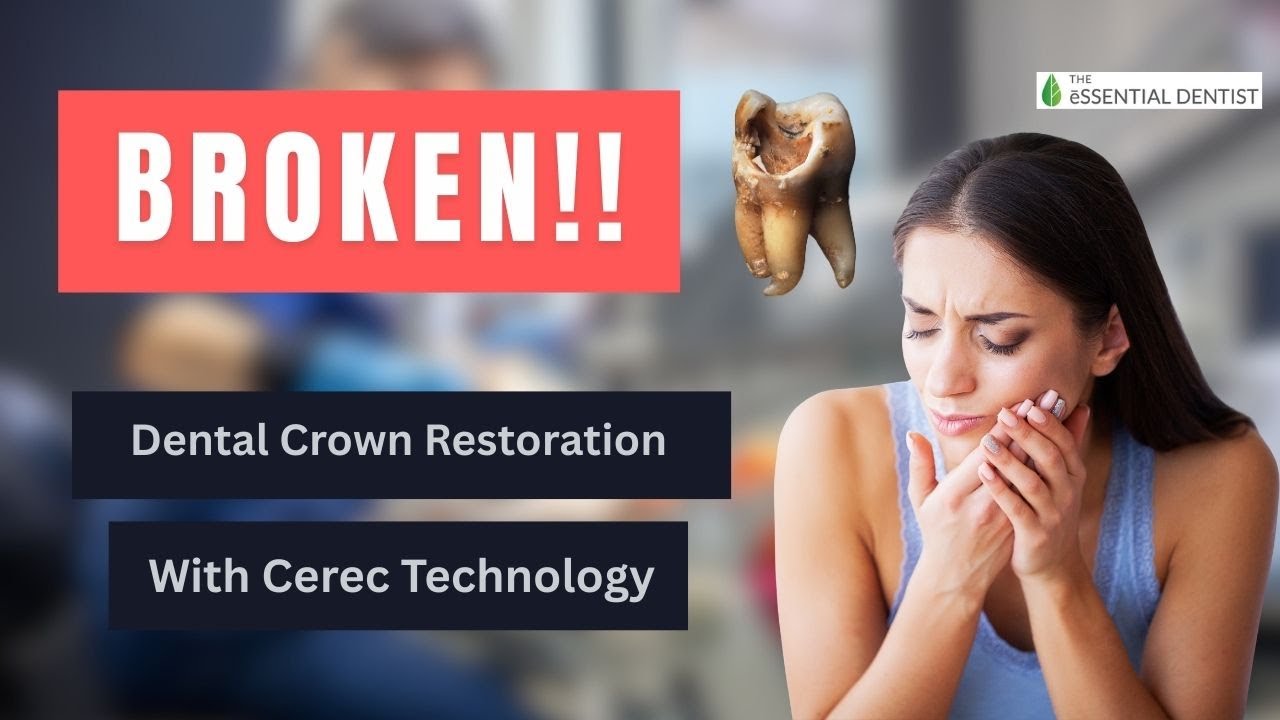 👉 Watch This Broken Tooth Transform! | Amazing Dental Crown Restoration