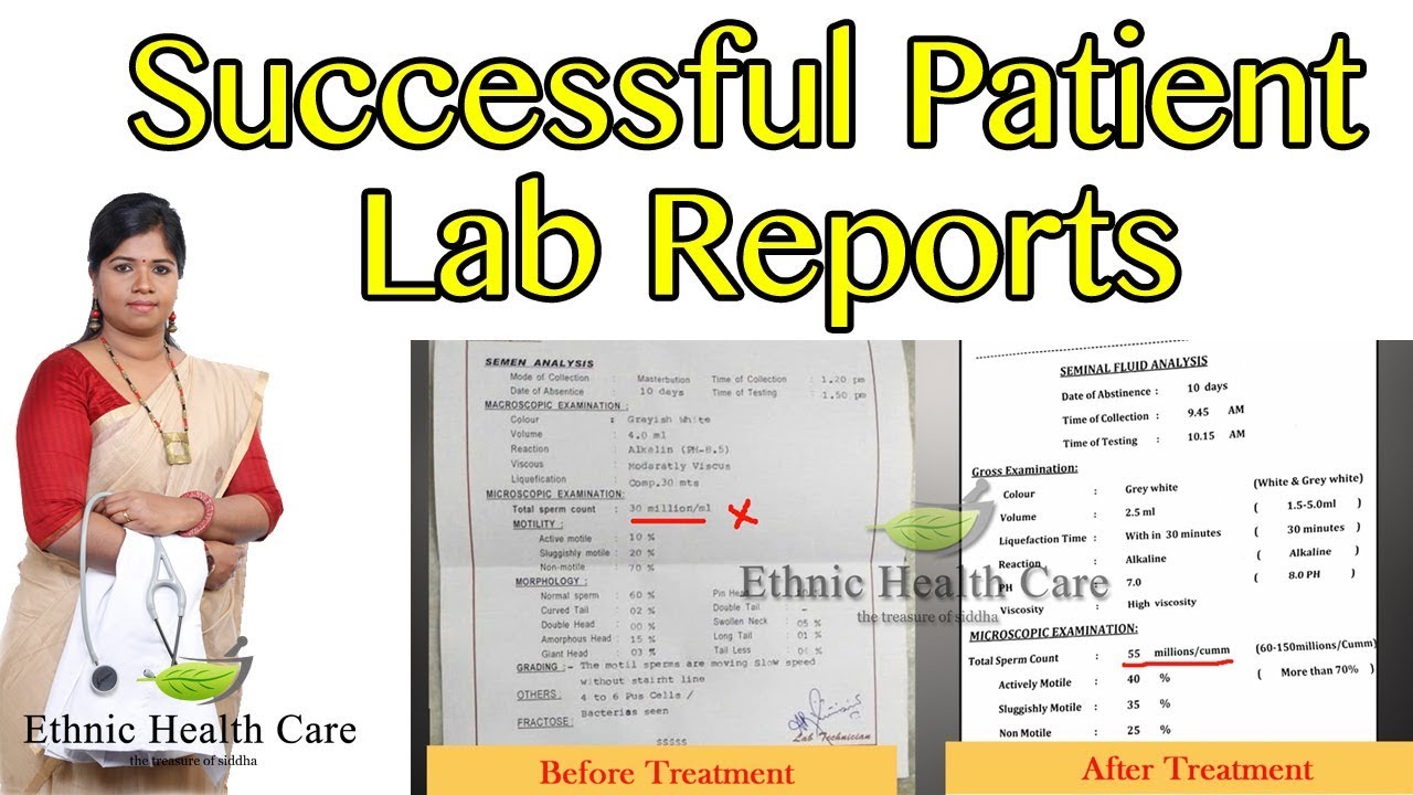 Ethnic Health Care Successful Patient Lab Reports - PCOD - Azoospermia- Sperm count Increase