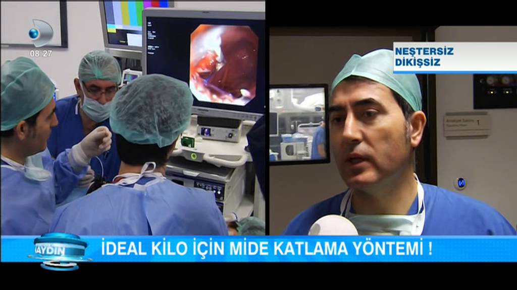 Kanal D İrfan Değirmenci ile Sabah Haberleri Apollo ameliyatsız, endoskopik mide küçültme