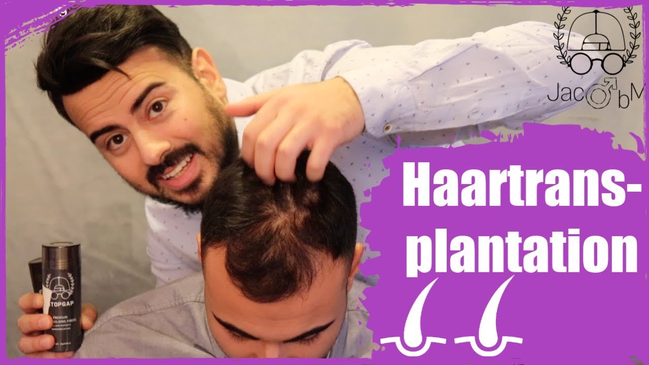 Transformation - volle Haare ohne Haartransplantation | Haarausfall