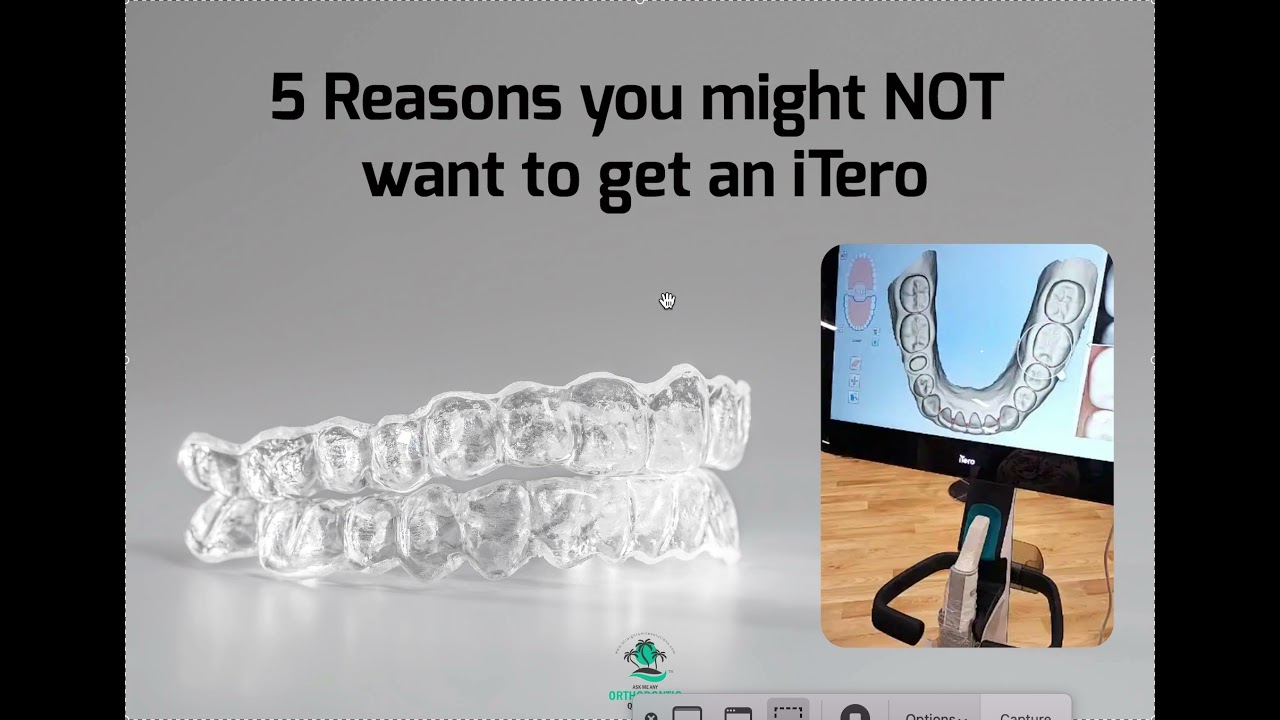 5 Reasons to NOT get an iTero