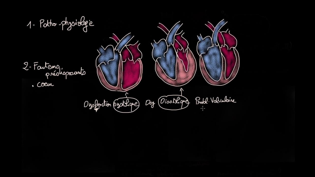 Oedème pulmonaire cardiogénique - Docteur Synapse