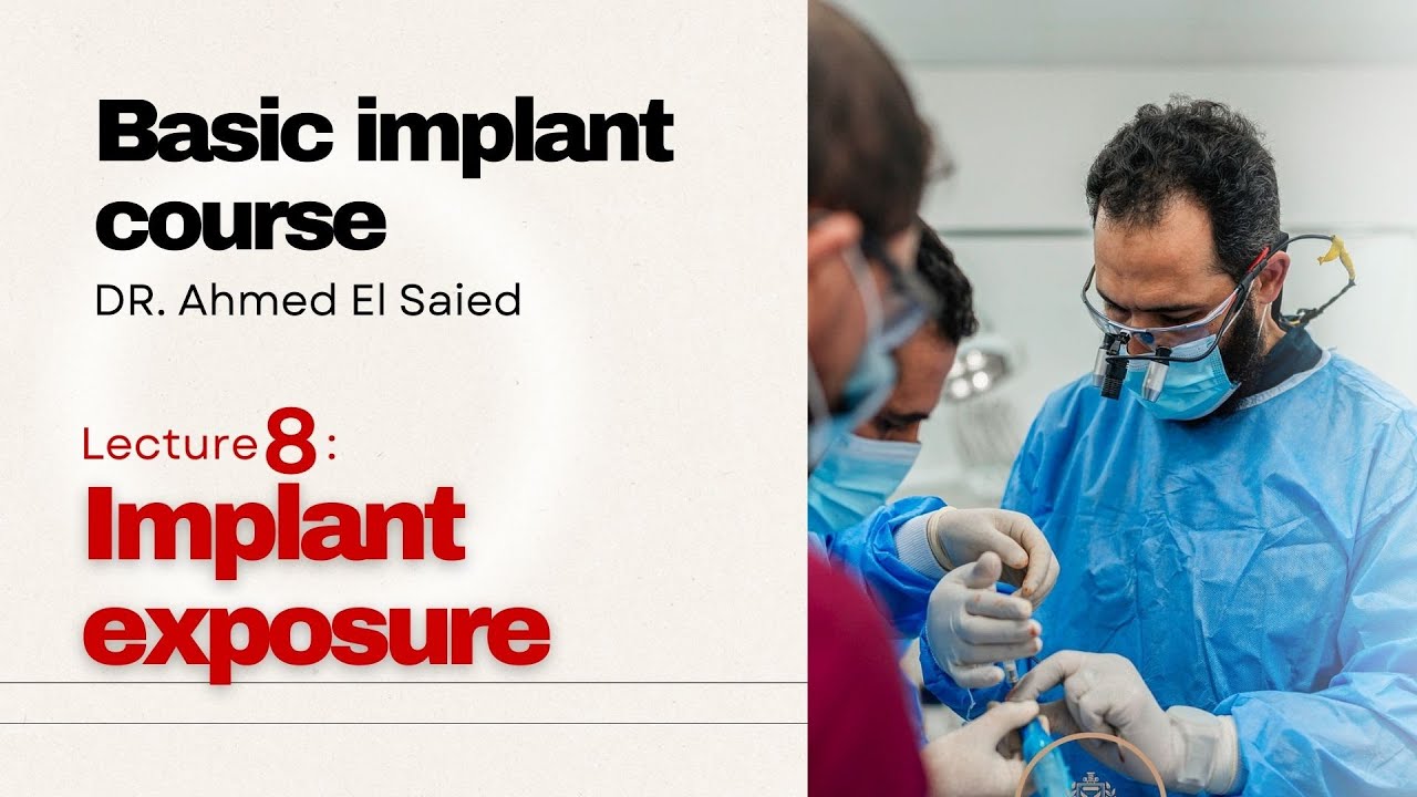 دردشات امبلانت 8 الفتح علي الزرعات implant course (implant exposure)
