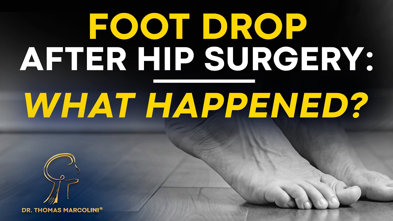 Отвисание стопы после операции на тазобедренном суставе — узнайте, что делать! ⚠️