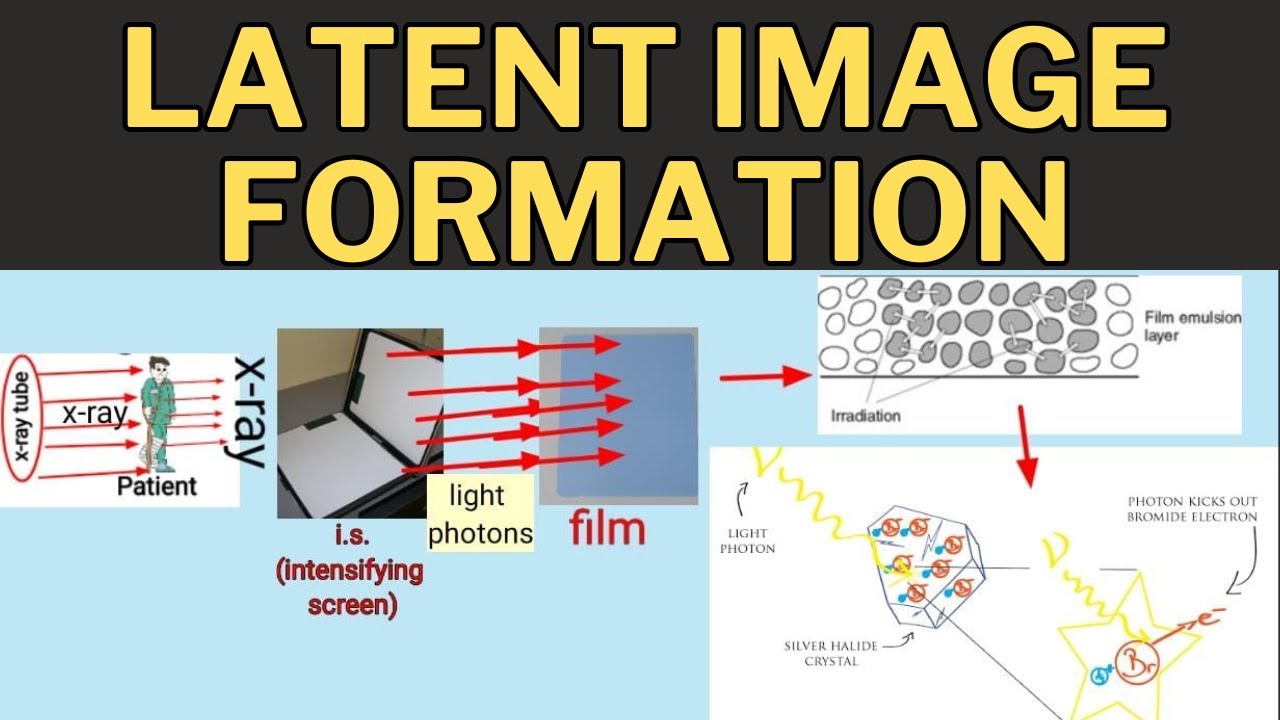 Latent image formation | Latent image | formation of Latent image in Radiography | invisible image|