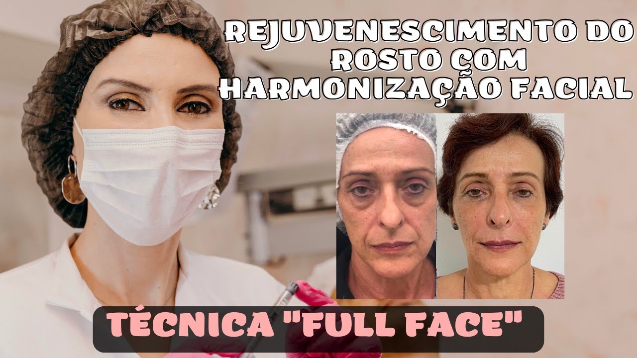 REJUVENESCIMENTO FACIAL COM HARMONIZAÇÃO FULL FACE