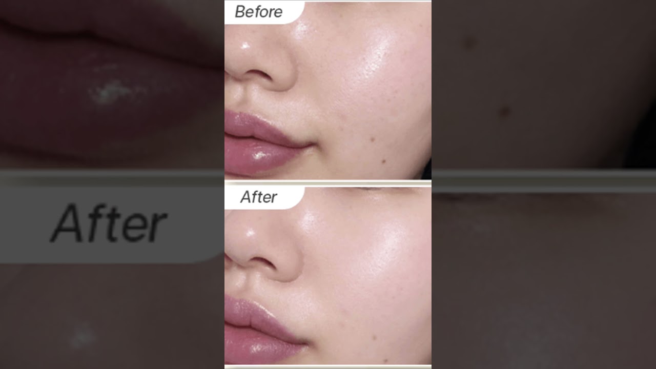 Top 3 Korean Sunscreens 