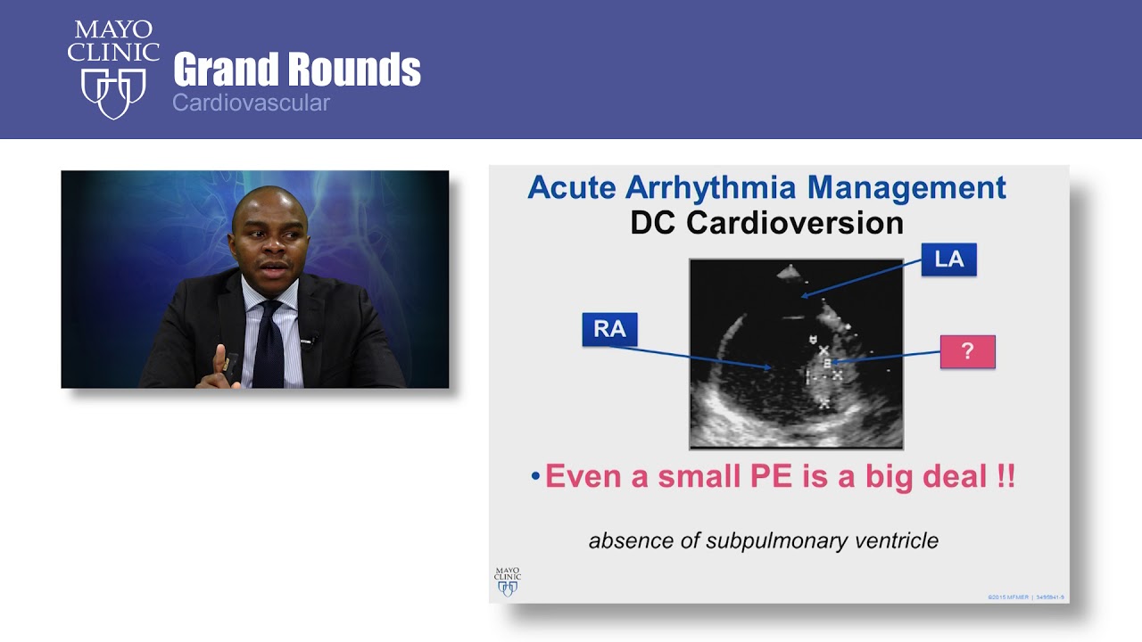 CV Grand Rounds &ndash; The Fontan Operation: Unanticipated Consequences
