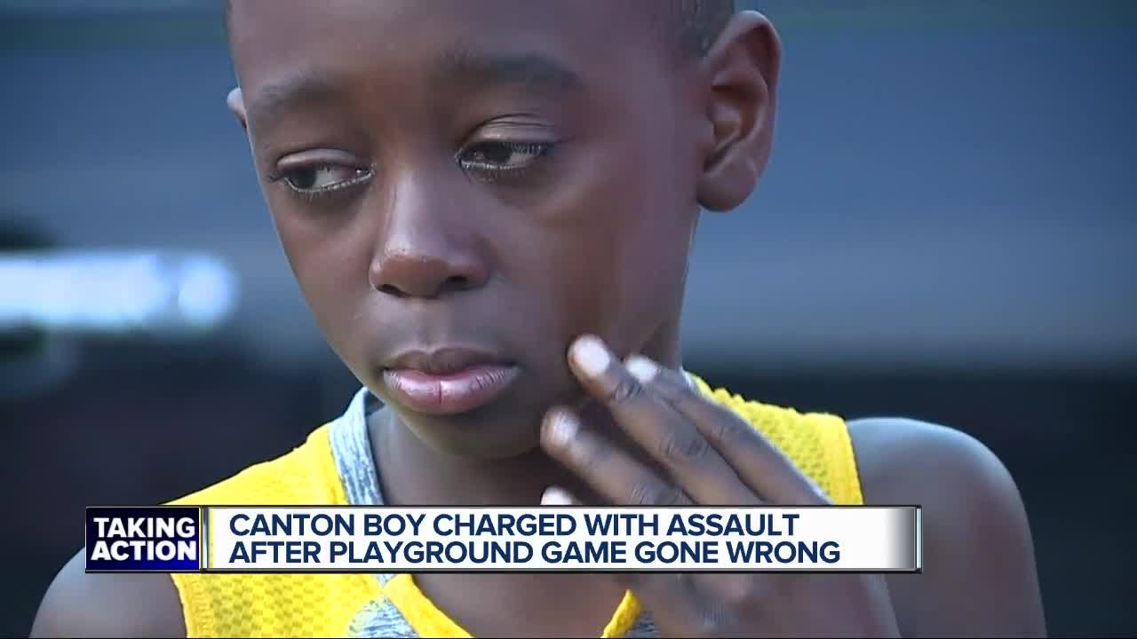 Canton 10-year-old charged with Assault following schoolyard injury