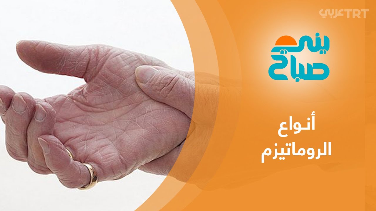 ما هي أنواع أمراض الروماتيزم التي تصيب الجسم وكيف يمكن علاجها؟