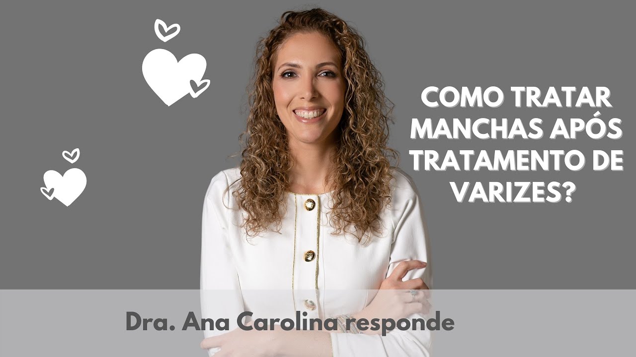Como tratar manchas ap&oacute;s tratamento de varizes