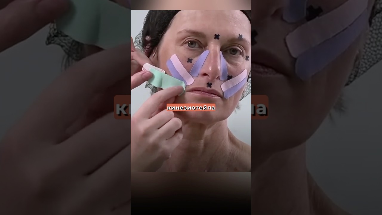 Проработка носогубных складок #bbalance #тейпирование #красотаназдоровье