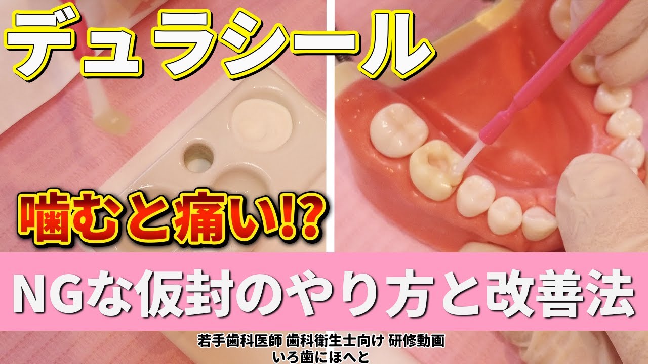 【筆積み法を徹底解説！】噛むと痛い！？NGなデュラシールと改善法