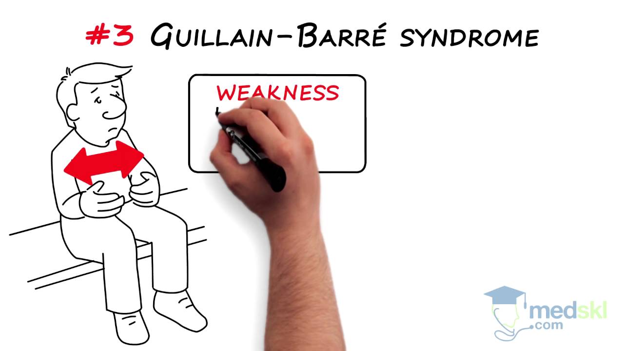 Neurology &ndash; Weakness, Paralysis, Paresis and/or Loss of Motion: By Charles Kassardjian M.D.