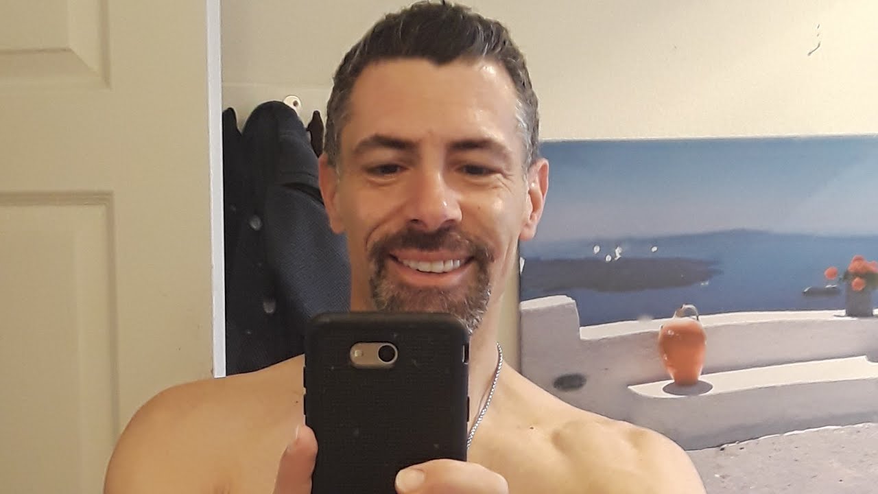 Wearing Dentures #8:  Two week update with a full set of immediate dentures (😁)