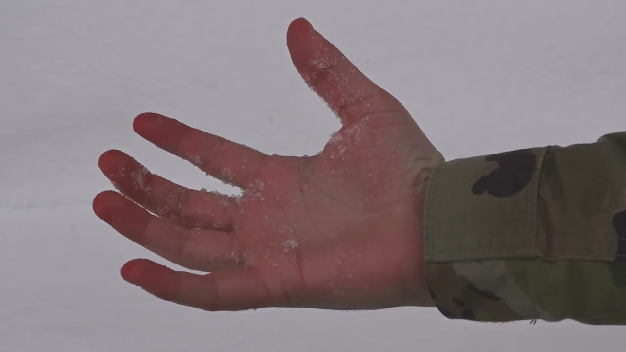 Minot Winter 101: Hypothermia & Frostbite