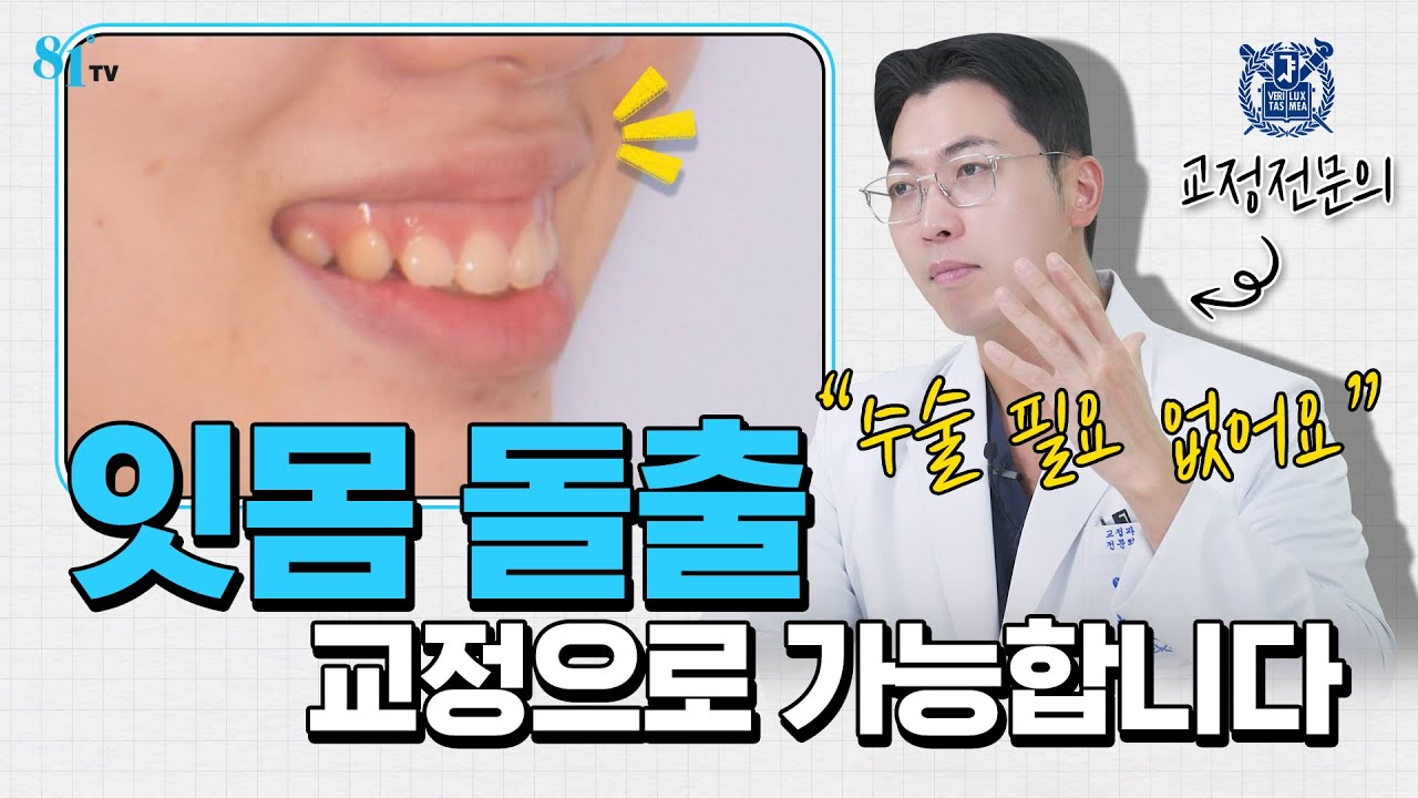 '잇몸 돌출' '턱뼈 돌출' 교정만으로 불가능하다구요? 증거로 설명드립니다.