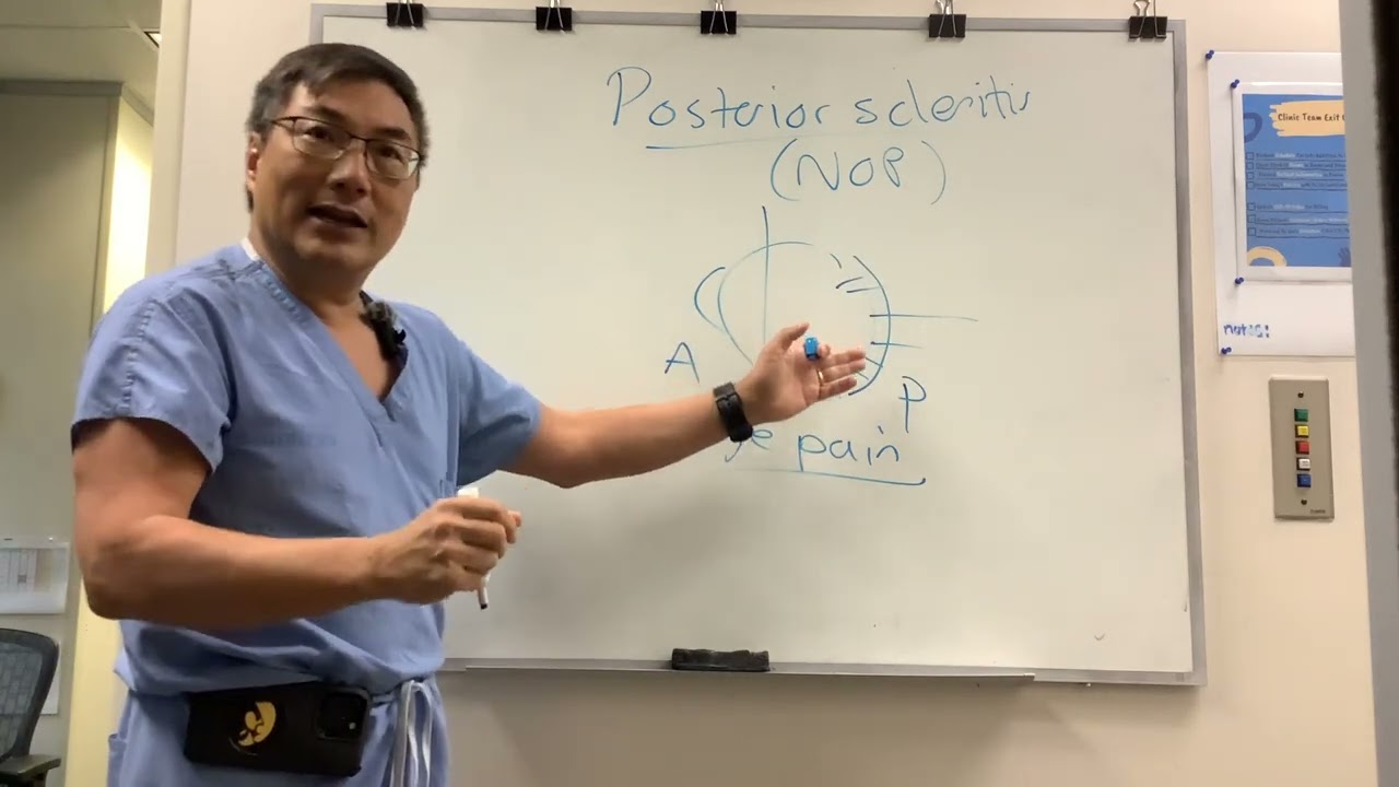 Posterior Scleritis