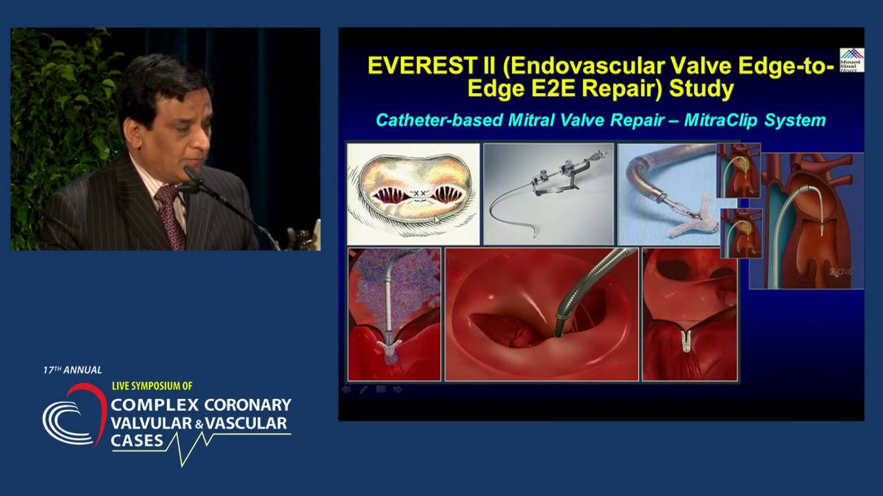 What Were the Top Ten Advances of Interventional Cardiology in 2013?