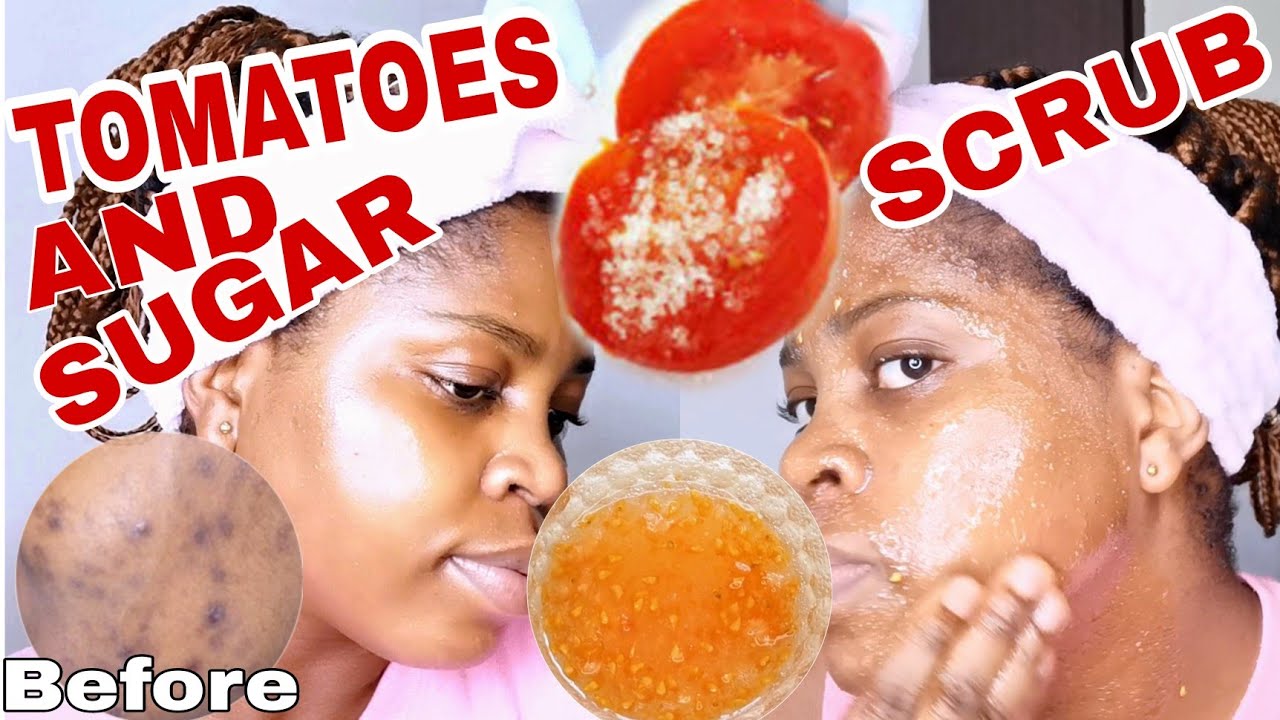 Tomatoes and sugar scrub on face | clear dark spots, sunburn and blemishes. Beauty by blizzy
