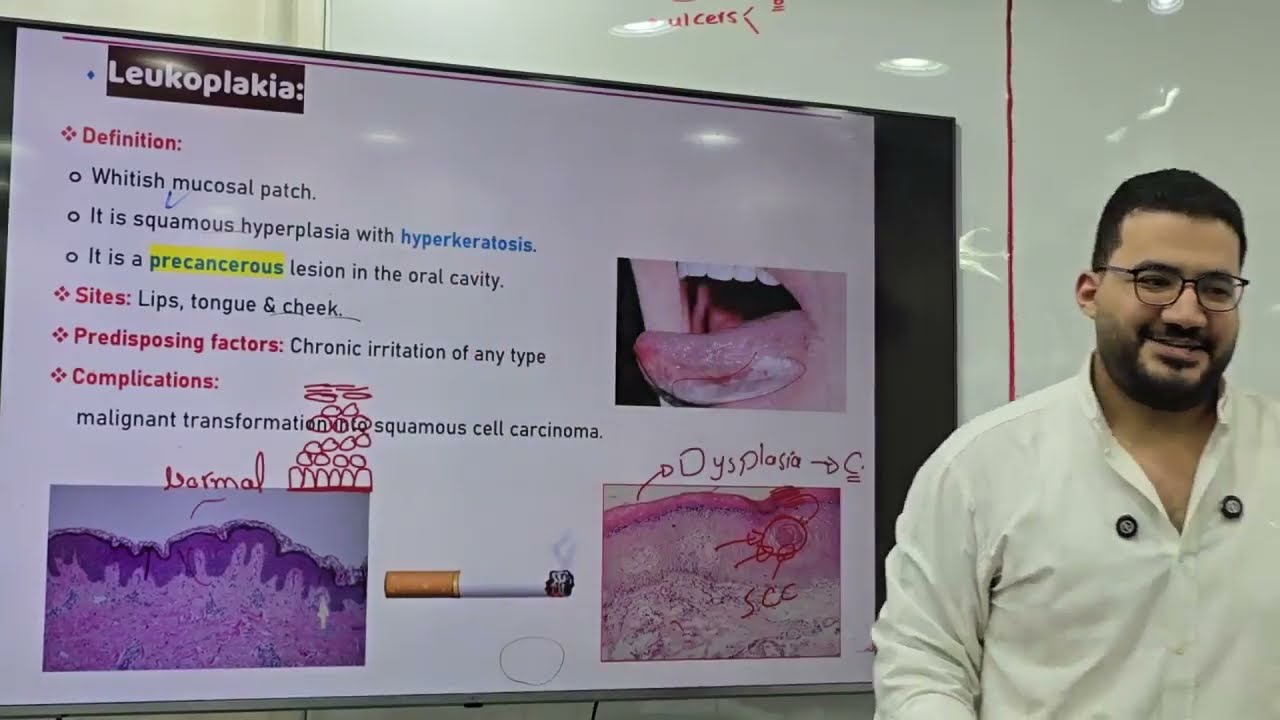 GIT Revision 1 (Oral Cavity + Salivary Gland + Esophagus + Stomach)