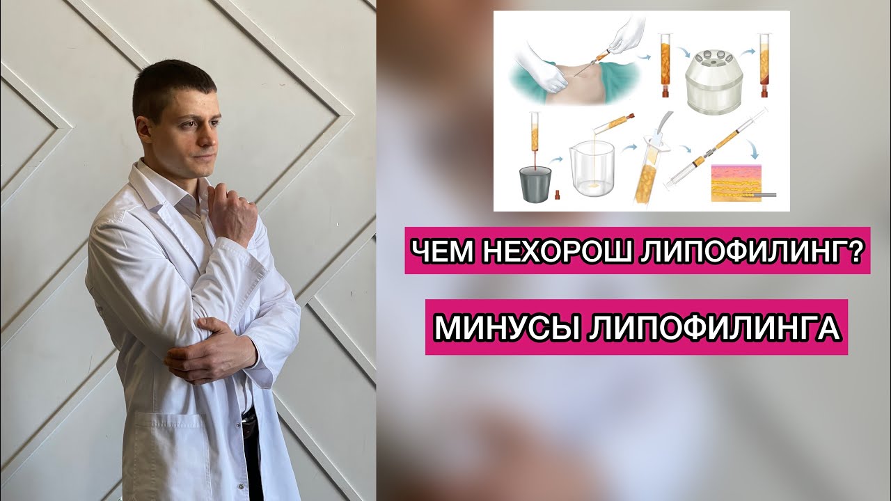 Чем НЕхорош липофилинг? Минусы липофиллинга Пластическая операция Пластический хирург Пластика