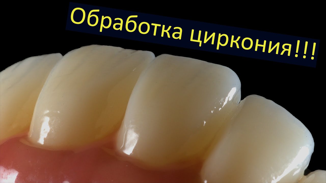 Обработка диоксида циркония. Коронки из циркона. Внутриротовое сканирование работает!