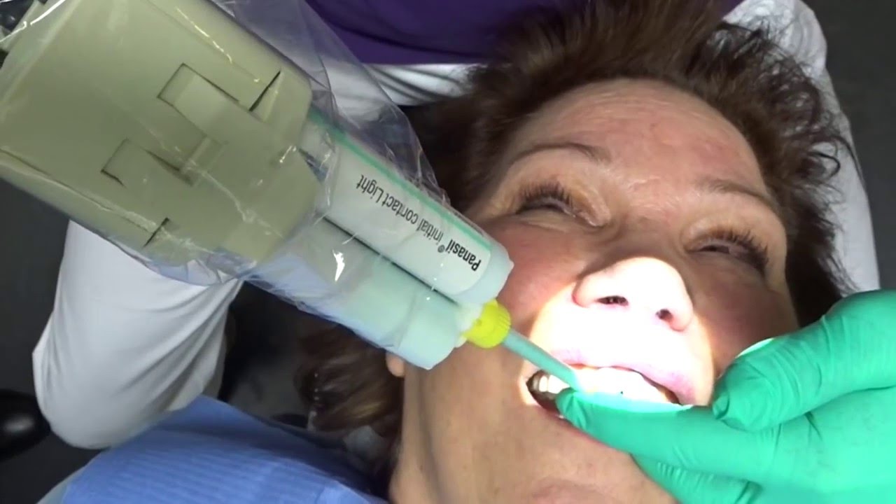 Panasil initial contact light en binetics putty soft