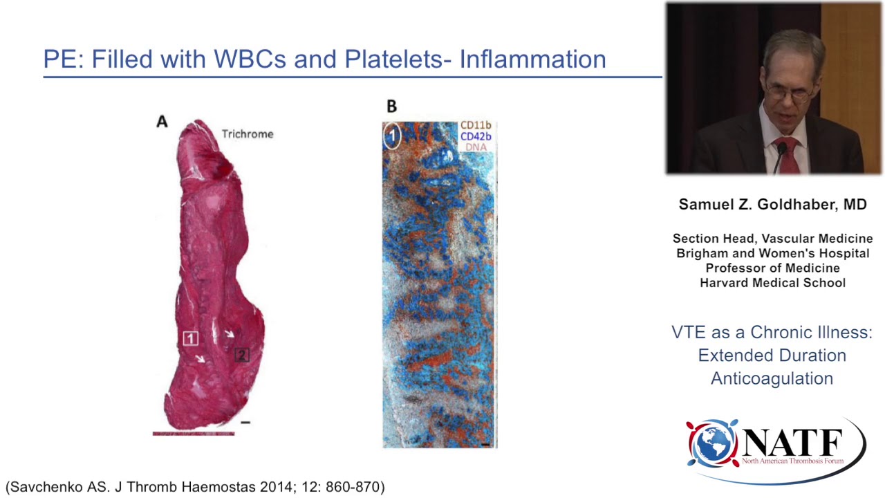 VTE As A Chronic Illness: Extended Duration Anticoagulation