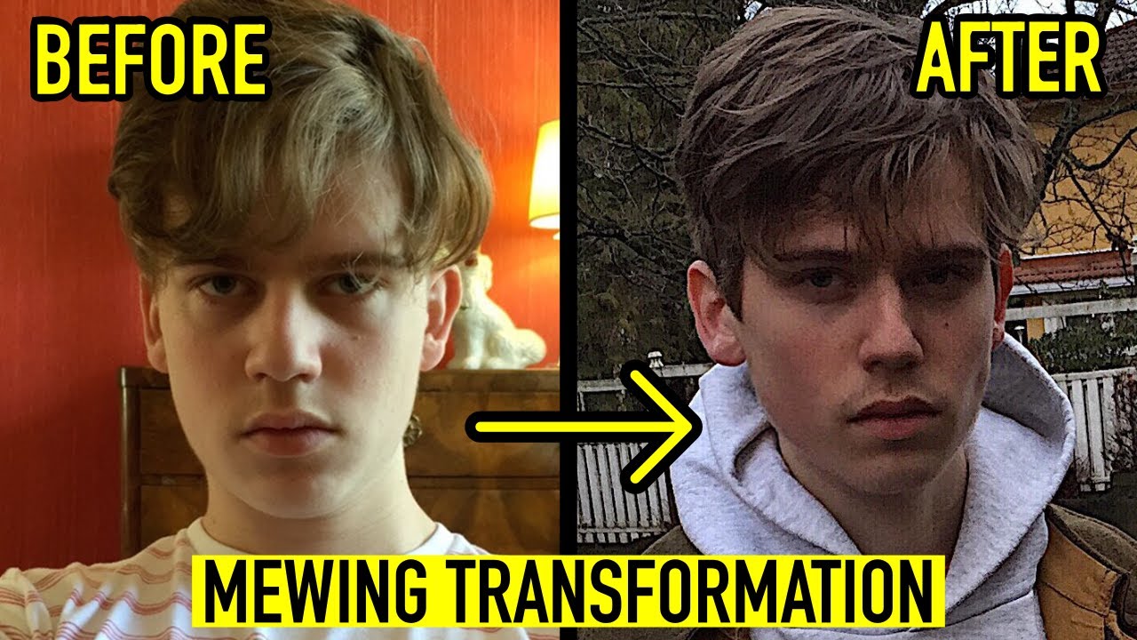 8 MONTH MEWING TRANSFORMATION VIDEO | 19 YEARS OLD BEFORE AND AFTER