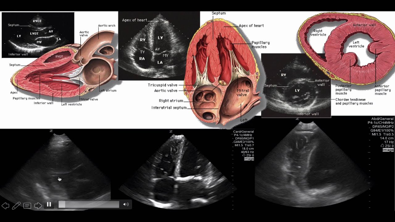 Ultrasound Education in Biochemistry Wet Beriberi