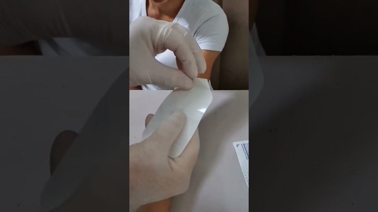 Como fixar o acesso venoso periférico Parte 2 #enfermagem