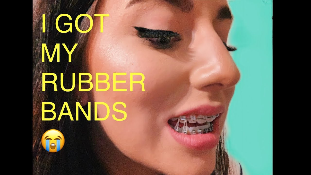 BRACES UPDATE:Rubber Bands SUCK & Mini Target Haul