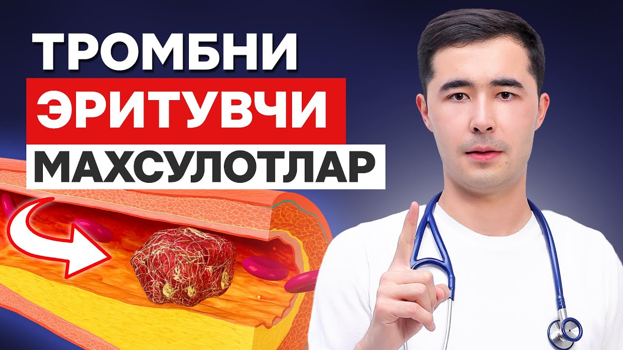 ТРОМБ ЭРИТУВЧИ ТОП 3 МАХСУЛОТ