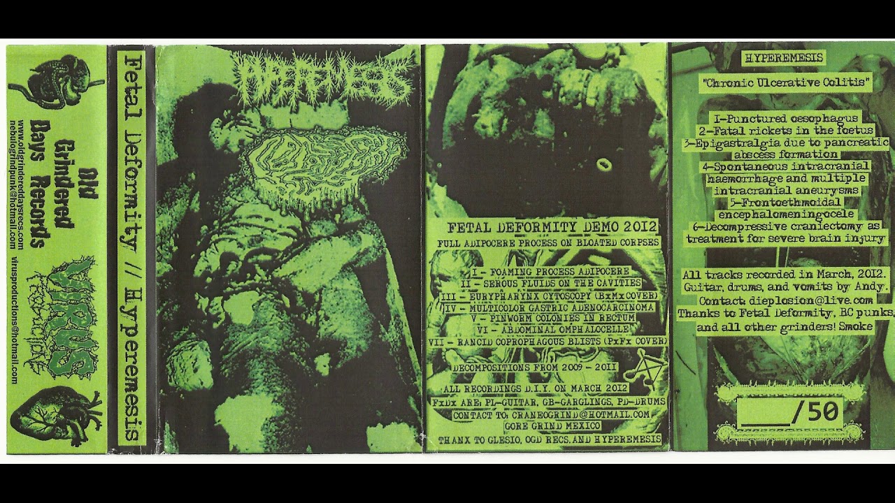 Hyperemesis/Fetal Deformity Split Tape