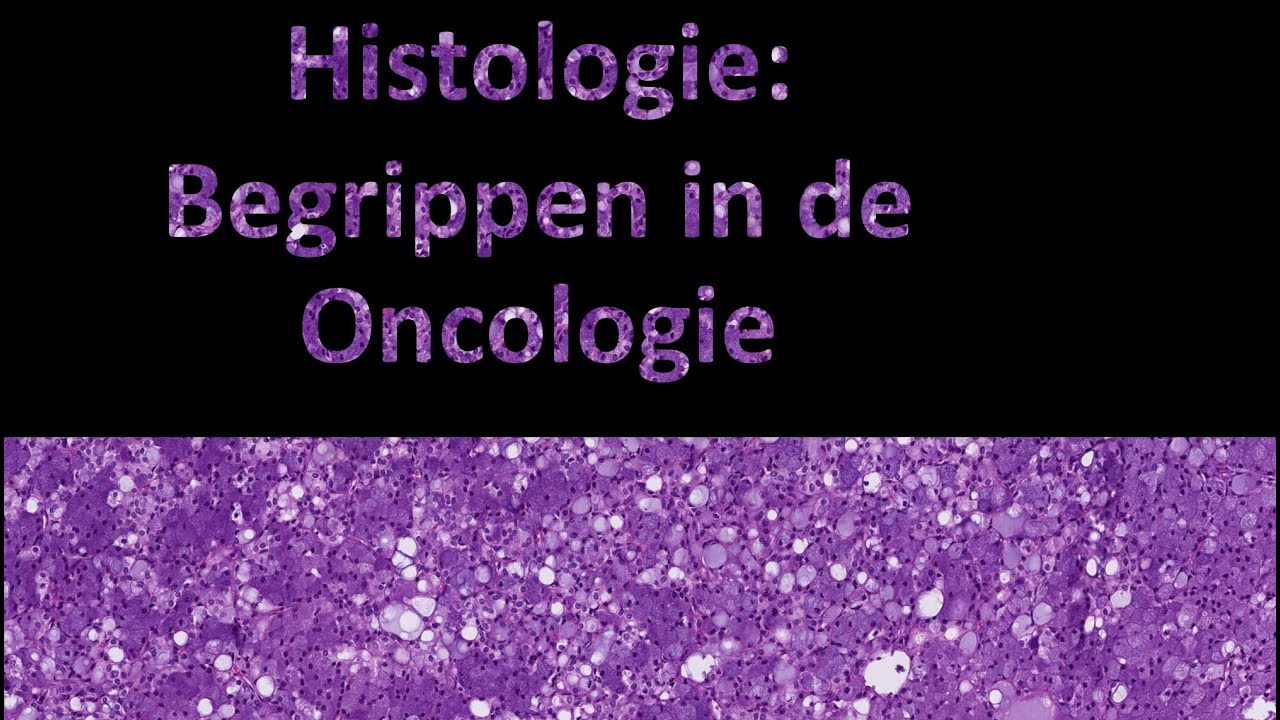 Wat is een tumor? wat is neoplasie? Wat is kanker? Begrippen in de oncologie!
