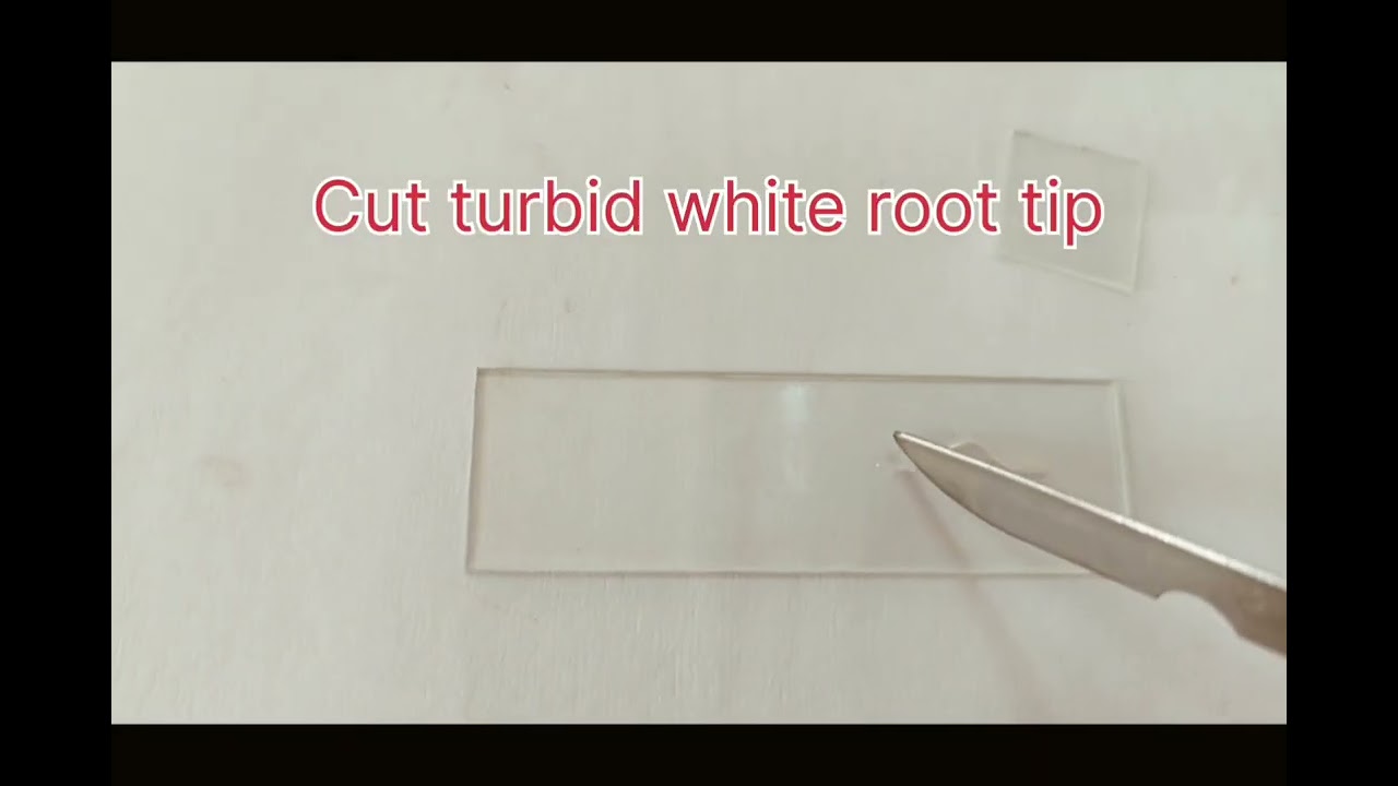 Mitosis in onion root tip Cells *11