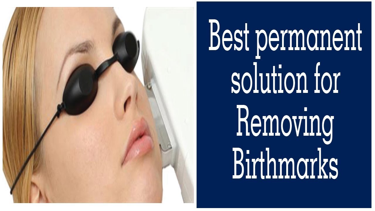Best Permanent Solution For Removing Birthmarks | Dr. Rinky Kapoor