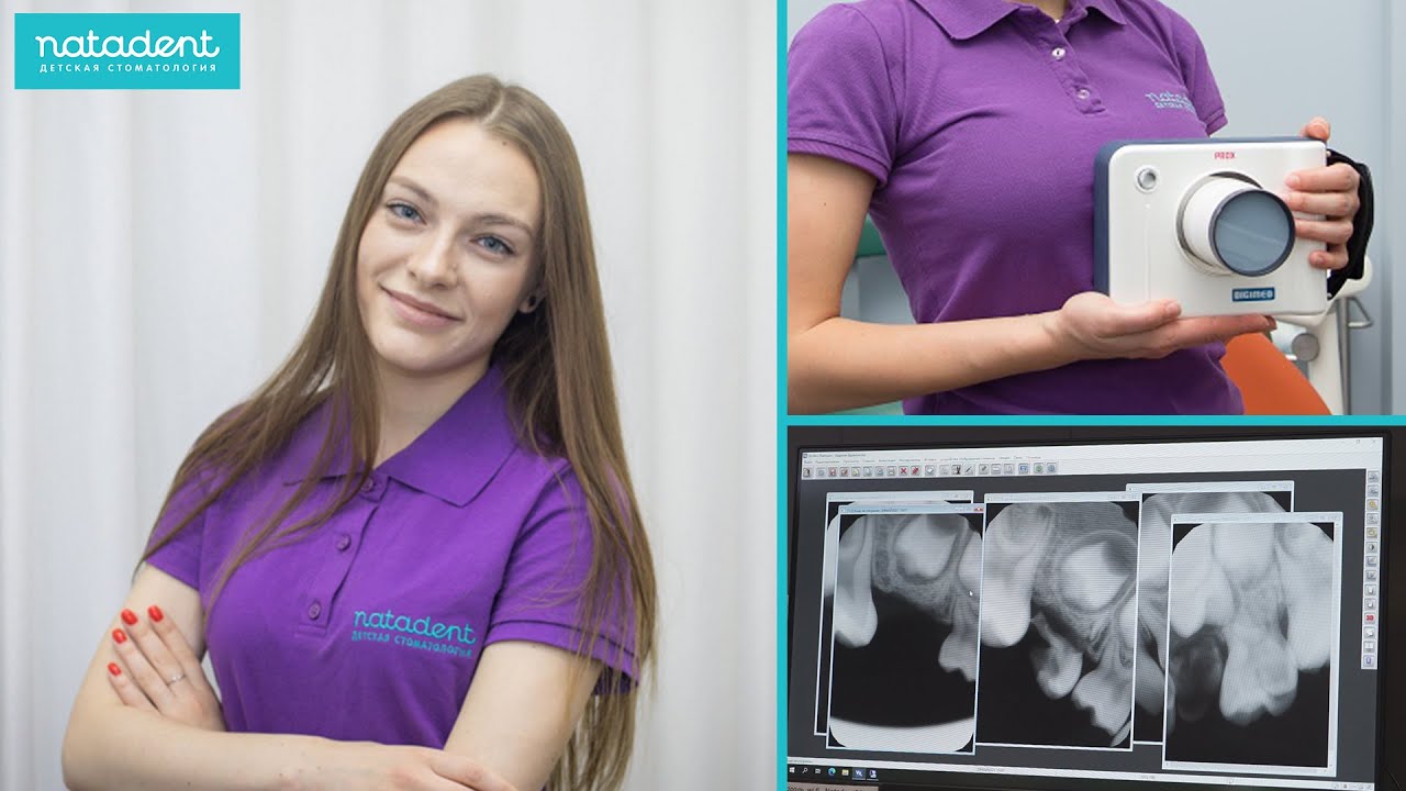 221. Мгновенный рентген радиовизиографом. Натадент