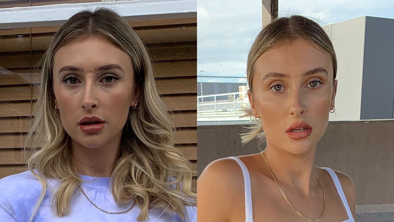 Getting Filler Injections!! Cheek Filler, Under eye filler?? Answering questions about filler