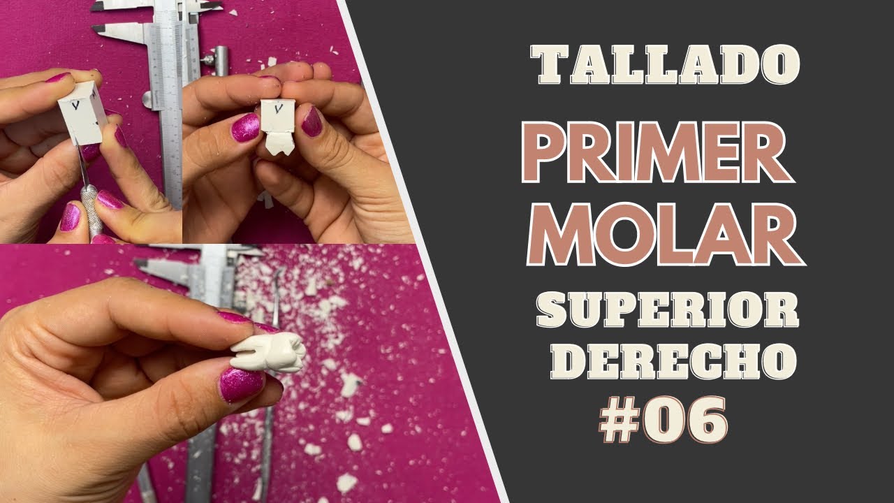 Tallado en cera de primer molar superior derecho | Odontologia con Cri