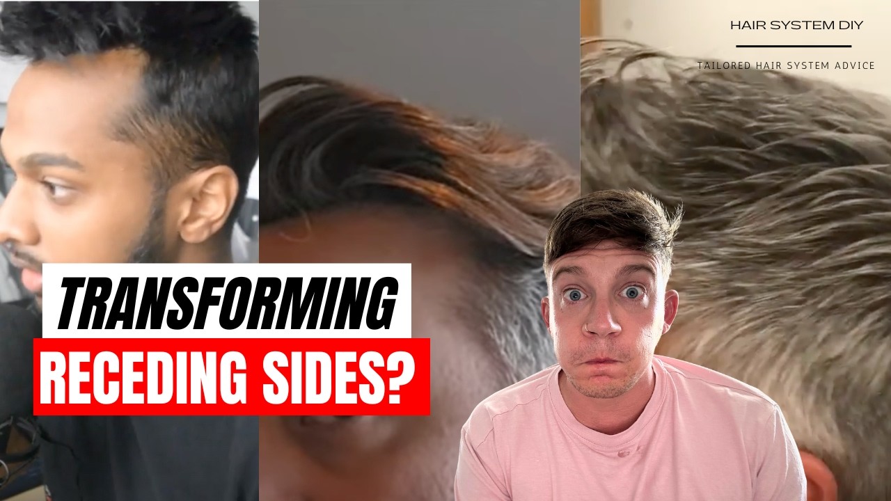 Reviewing Hair Systems for Thinning or Receding Sides!