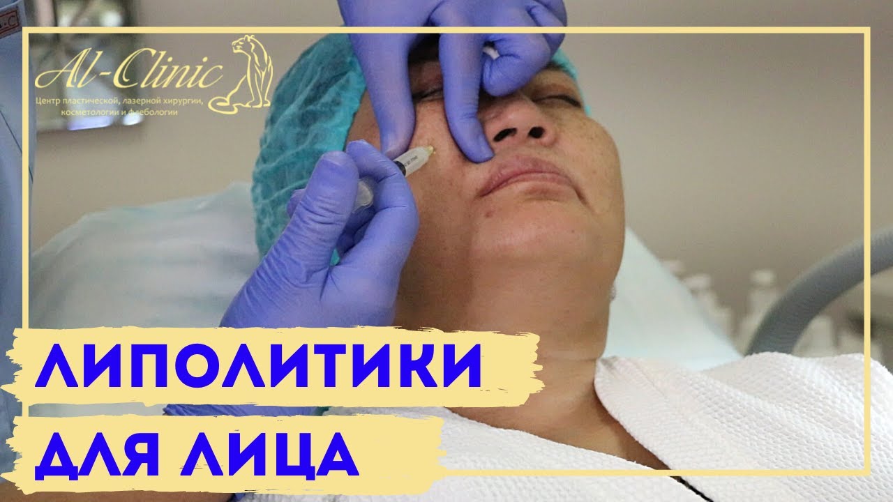 ЛИПОЛИТИКИ В ЛИЦО💉 || ХУДЕЕМ БЕЗ ДИЕТ || ПРОЩАЙ ВТОРОЙ ПОДБОРОДОК👋🏻  || Light Fit