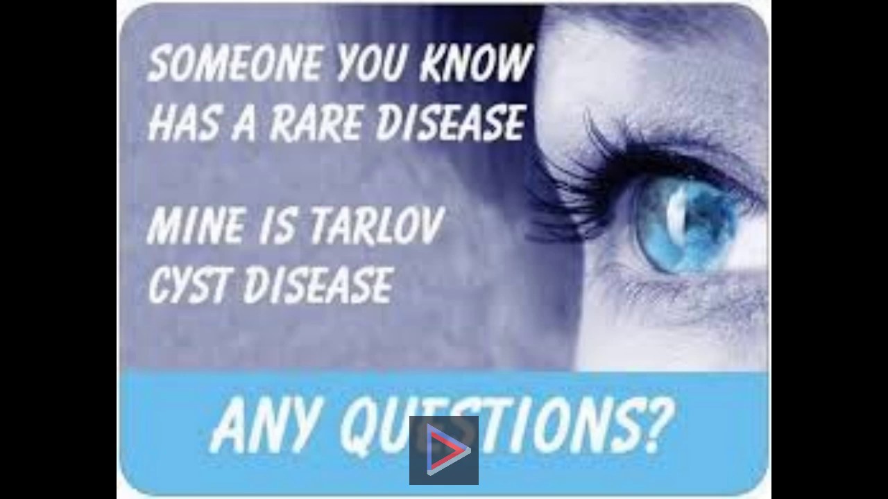 Tarlov Cyst Disease - Much More than an Incidental Finding - AJNR