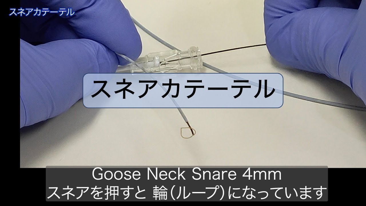 スネアカテーテルによるコイル・接着カテーテルの回収